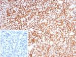 Clusterin/Apolipoprotein J (APO-J) Antibody in Immunohistochemistry (Paraffin) (IHC (P))