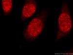 HuR Antibody in Immunocytochemistry (ICC/IF)