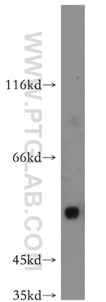 Uromodulin Antibody in Western Blot (WB)