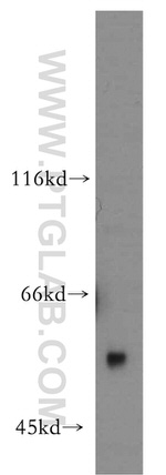 Uromodulin Antibody in Western Blot (WB)