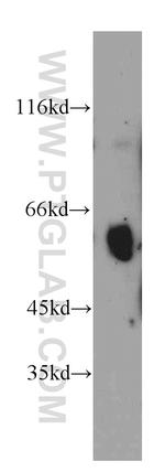 Uromodulin Antibody in Western Blot (WB)