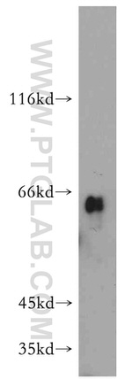 Uromodulin Antibody in Western Blot (WB)