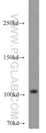 Sec8 Antibody in Western Blot (WB)