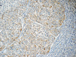 RABL3 Antibody in Immunohistochemistry (Paraffin) (IHC (P))