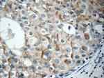 RABL3 Antibody in Immunohistochemistry (Paraffin) (IHC (P))