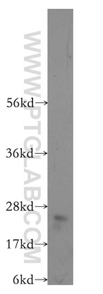 RABL3 Antibody in Western Blot (WB)