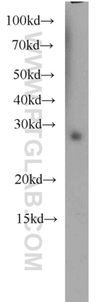 RABL3 Antibody in Western Blot (WB)