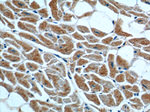 ST2 Antibody in Immunohistochemistry (Paraffin) (IHC (P))