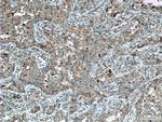 ST2 Antibody in Immunohistochemistry (Paraffin) (IHC (P))