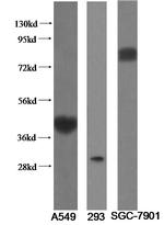 ST2 Antibody in Western Blot (WB)