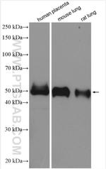 ST2 Antibody in Western Blot (WB)