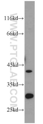 ST2 Antibody in Western Blot (WB)