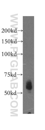 Kininogen 1 Antibody in Western Blot (WB)