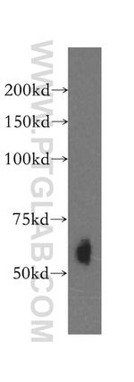 Kininogen 1 Antibody in Western Blot (WB)