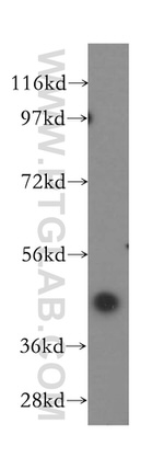 Kininogen 1 Antibody in Western Blot (WB)