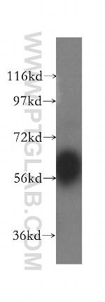 Kininogen 1 Antibody in Western Blot (WB)