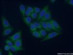 COMMD1 Antibody in Immunocytochemistry (ICC/IF)