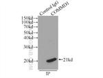 COMMD1 Antibody in Immunoprecipitation (IP)