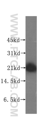 COMMD1 Antibody in Western Blot (WB)