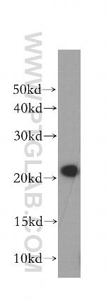 COMMD1 Antibody in Western Blot (WB)