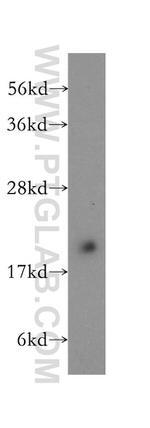 COMMD1 Antibody in Western Blot (WB)