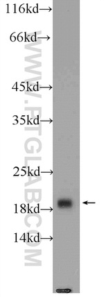 COMMD1 Antibody in Western Blot (WB)