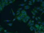 SCHIP1 Antibody in Immunocytochemistry (ICC/IF)