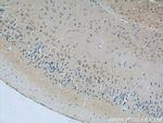 SCHIP1 Antibody in Immunohistochemistry (Paraffin) (IHC (P))