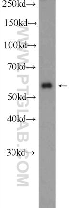 SCHIP1 Antibody in Western Blot (WB)