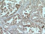 GAS2 Antibody in Immunohistochemistry (Paraffin) (IHC (P))