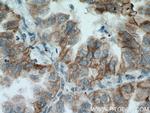 GAS2 Antibody in Immunohistochemistry (Paraffin) (IHC (P))