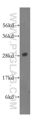 PSMA4 Antibody in Western Blot (WB)