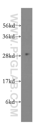 PSMA4 Antibody in Western Blot (WB)