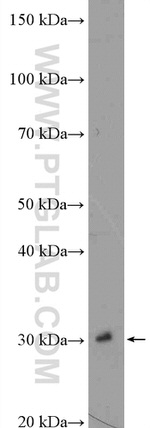 PSMA4 Antibody in Western Blot (WB)