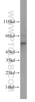 STEAP4 Antibody in Western Blot (WB)