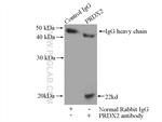 RAB5A Antibody in Immunoprecipitation (IP)