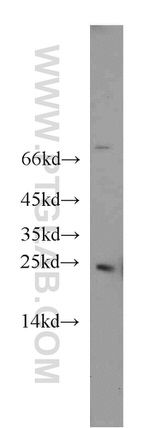 RAB5A Antibody in Western Blot (WB)