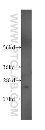 RAB5A Antibody in Western Blot (WB)