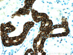 RHCG Antibody in Immunohistochemistry (Paraffin) (IHC (P))