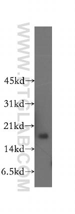 CBP20 Antibody in Western Blot (WB)