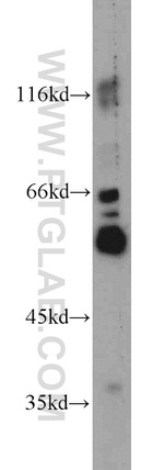 TRIM6 Antibody in Western Blot (WB)