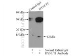 DYNLT1 Antibody in Immunoprecipitation (IP)