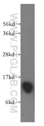 DYNLT1 Antibody in Western Blot (WB)