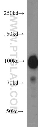 HELLS Antibody in Western Blot (WB)