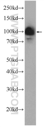 HELLS Antibody in Western Blot (WB)