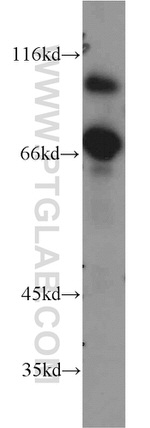 BRIT1 Antibody in Western Blot (WB)