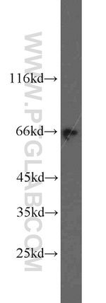 BRIT1 Antibody in Western Blot (WB)