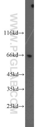 BRIT1 Antibody in Western Blot (WB)