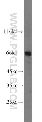 BRIT1 Antibody in Western Blot (WB)