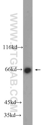 BRIT1 Antibody in Western Blot (WB)